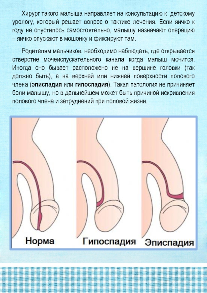 Идеално Ровные Члены