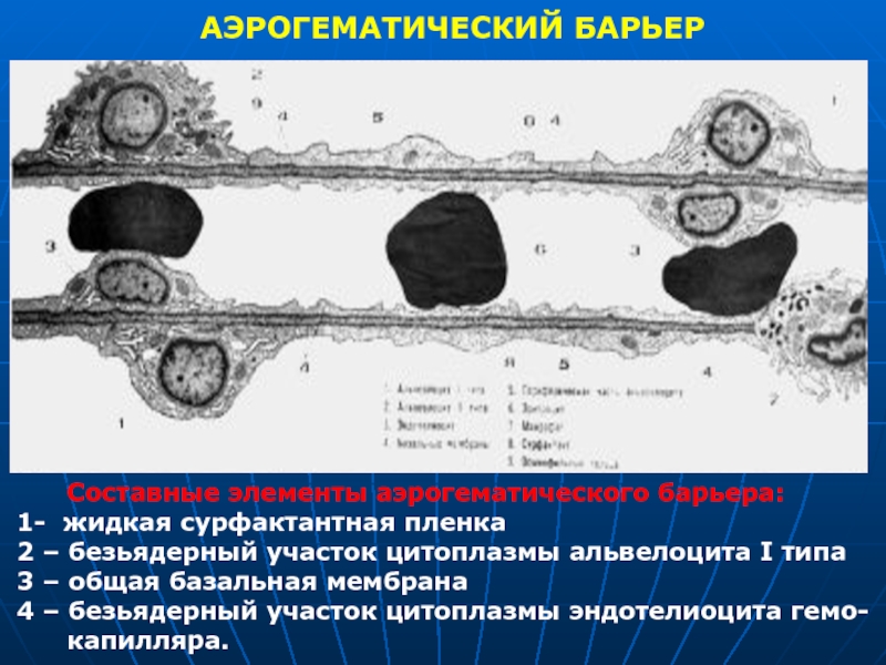 Схема строения аэрогематического барьера