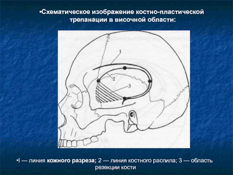 Схематическое изображение пульсара