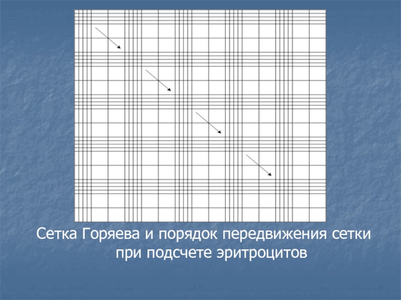 Камера горяева картинки