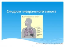 Синдром плеврального выпота