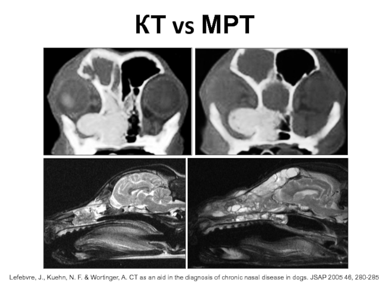 КТ vs МРТМРТLefebvre, J., Kuehn, N. F. & Wortinger, A. CT as an aid in the diagnosis
