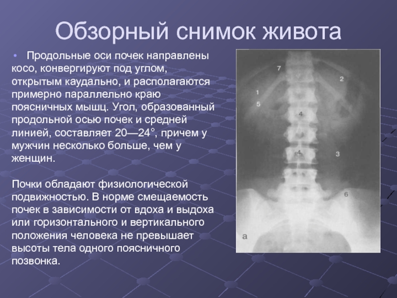 Лучевая диагностика заболеваний почек презентация