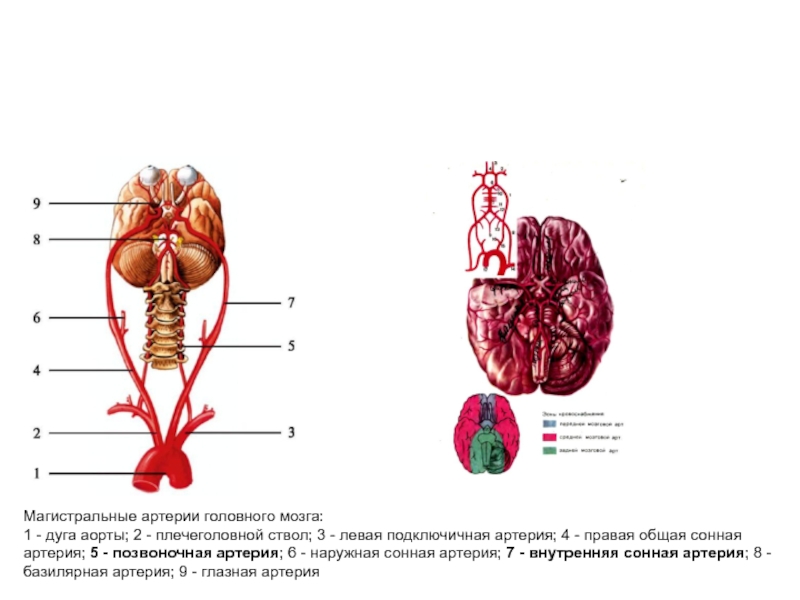 Магистральные артерии мозга. Магистральные артерии головного. Немагистральные артерии это. Магистральные артерии клиническая анатомия. Магистральные сосуды головы.