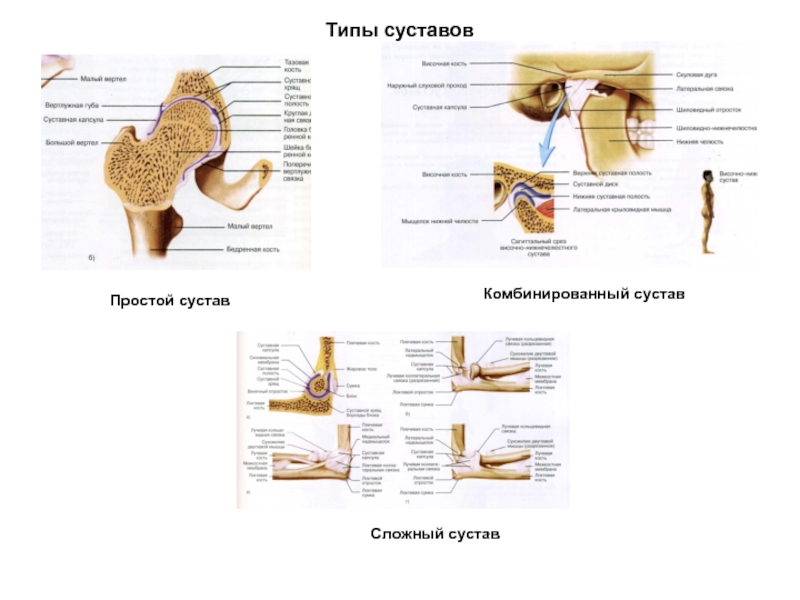 Сложный сустав. Комбинированный сустав это в анатомии. Комбинированные суставы. Сложные суставы. Простой сустав.