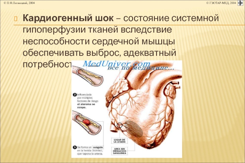 Коронарная недостаточность презентация