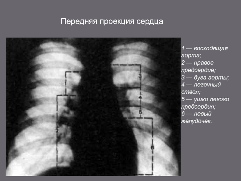 Рентген сердца фото