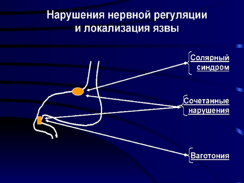 Язвенная болезнь факультетская терапия презентация