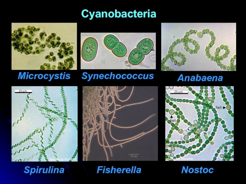 Группы организмов цианобактерии. Цианобактерии ANABAENAANABAENA:. Синезелёные водоросли цианобактерии. Носток цианобактерия. Носток и Анабена.