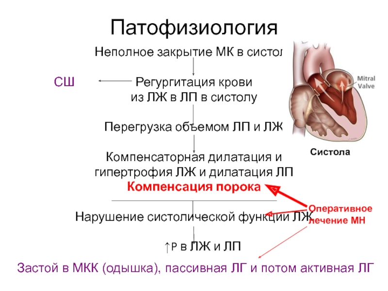 Митральные пороки сердца презентация