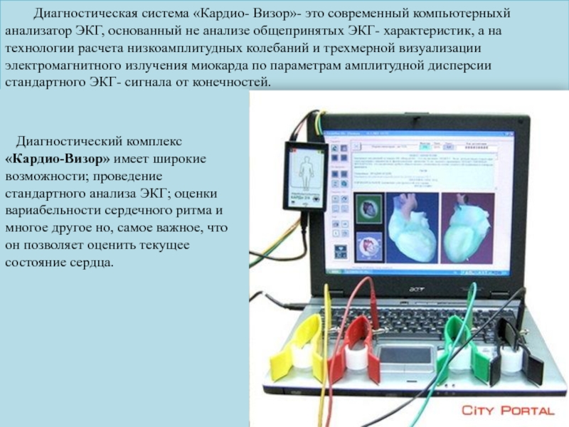 Диагностические системы. ЭКГ анализатор. Диагностическая система параметров ЭКГ. Компьютеризированные системы ЭКГ.