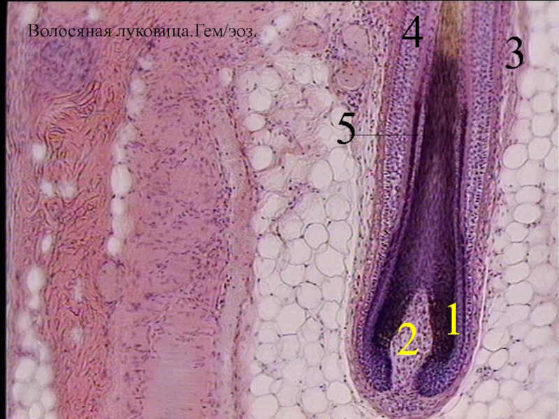 Корень волоса фото. Волосяной фолликул микрофотография. Кожа пальца гистология препарат. Кожа пальца человека гистология препарат. Волосяная луковица гистология.