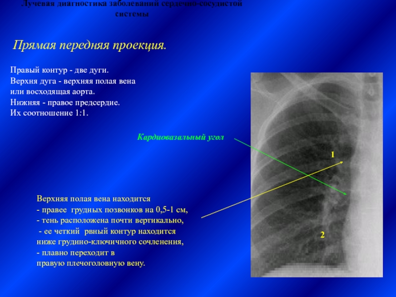 Лучевая диагностика сердечно сосудистой системы презентация