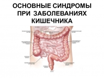 ОСНОВНЫЕ СИНДРОМЫ ПРИ ЗАБОЛЕВАНИЯХ КИШЕЧНИКА