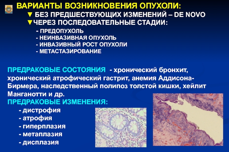 Рак возникновение. Опухоль это патологический процесс. Процесс возникновения опухоли. Стадии образования опухоли. Опухоль понятие стадии развития.