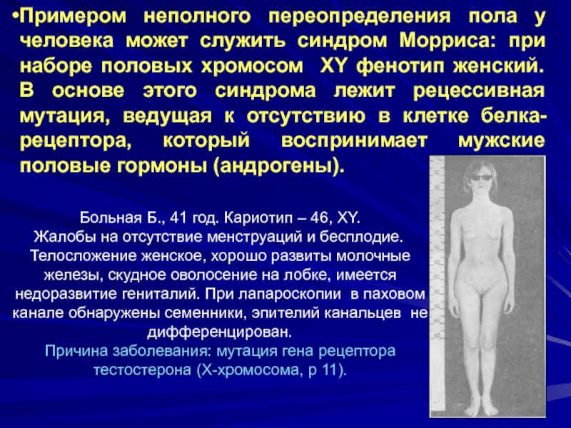 Нечувствительность к андрогенам. Синдром Морриса. Схема развития синдрома Морриса. Синдром Морриса мутация. Половые органы людей с синдромом Морриса.