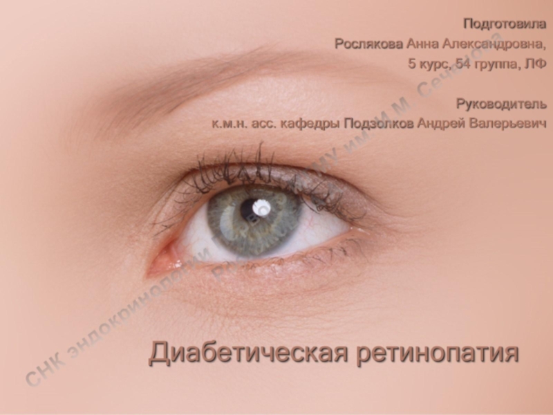 Диабетическая ретинопатия  