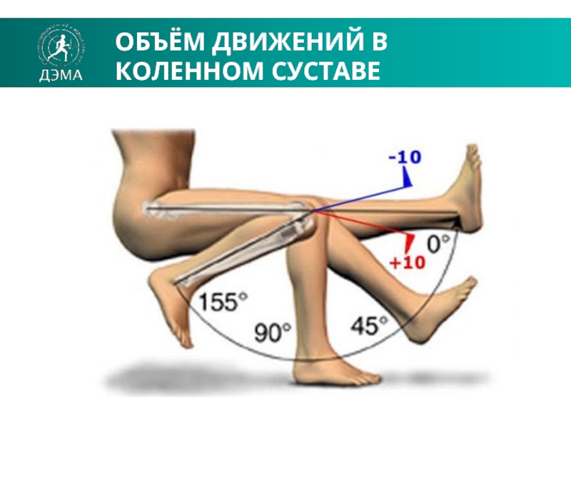 Пункция коленного сустава фото