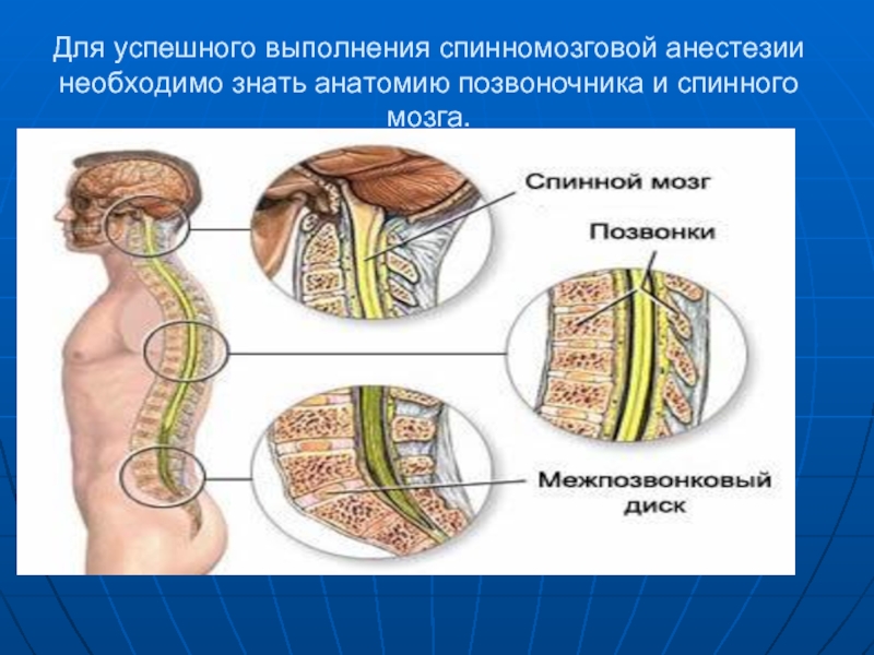 Спинномозговая анестезия. Спинномозговая анестезия анатомия. Спинальная анестезия анатомия. Спинально мозговая анестезия. Анестезия в спинной мозг.