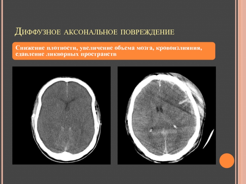 Дап кт картина