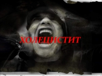 Холецистит 