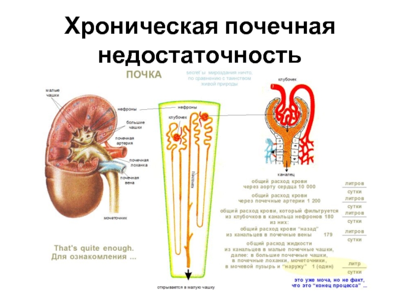 Презентация Хроническая почечная недостаточность