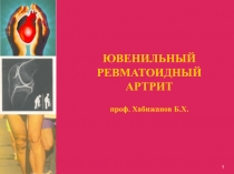 ЮВЕНИЛЬНЫЙ РЕВМАТОИДНЫЙ АРТРИТ проф. Хабижанов Б.Х