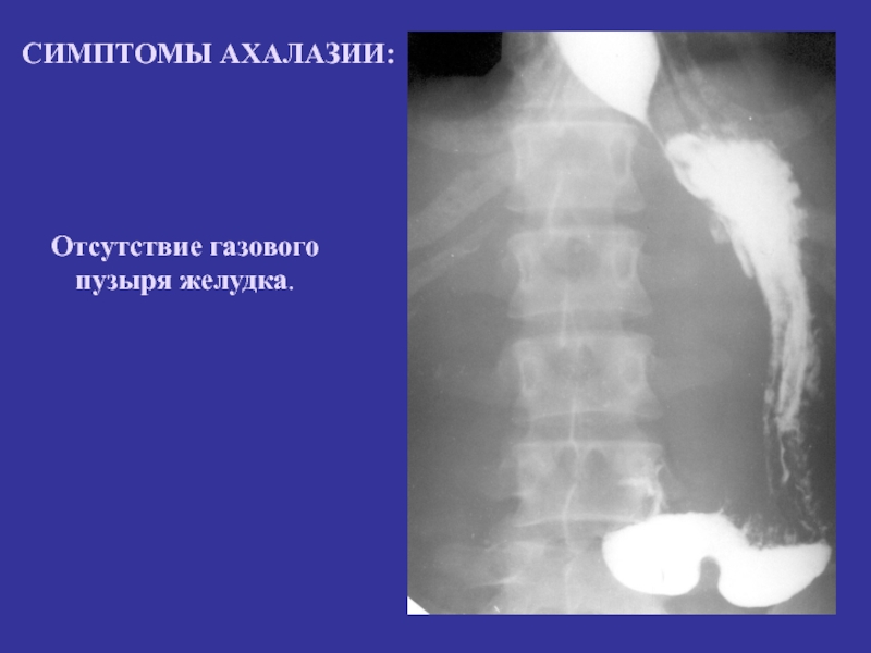 Лучевая диагностика пищевода презентация