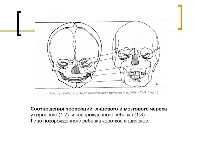 Череп ребенка рисунок