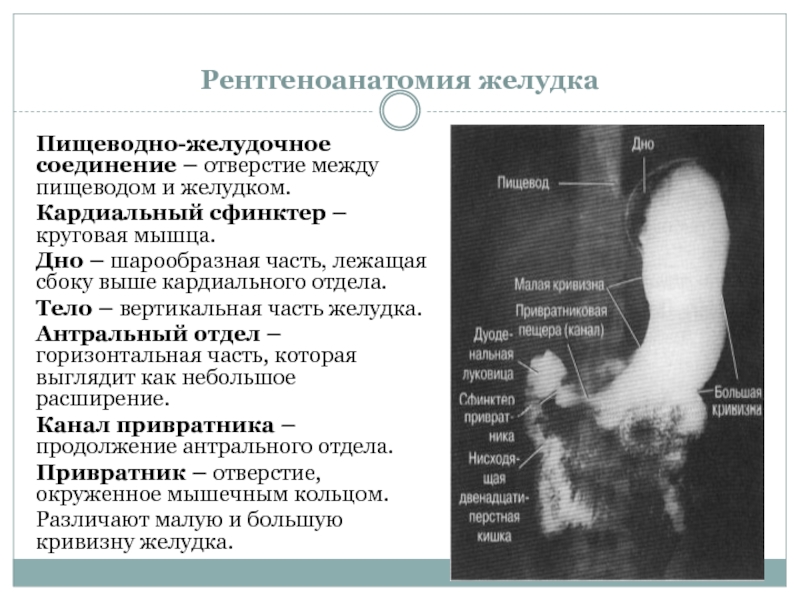 Лучевая диагностика пищевода презентация