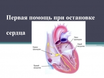 ПЕРВАЯ ПОМОЩЬ ПРИ ОСТАНОВКЕ СЕРДЦА