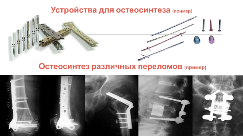 Травматология переломы презентация