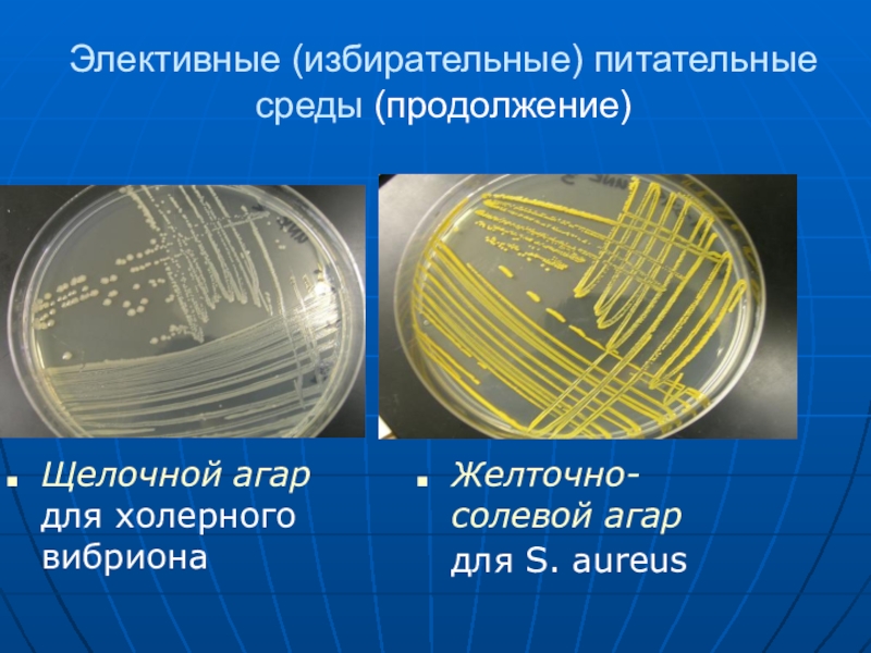 Агар и бульон хоттингера предназначение