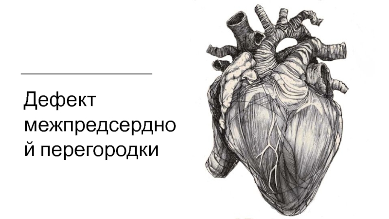 Презентация Дефект межпредсердной перегородки