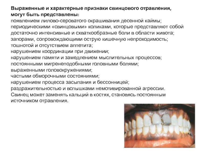 Сатурнизм это. Отравление свинцом симптомы. Кайма на деснах при отравлении свинцом. Кайма при сатурнизм.
