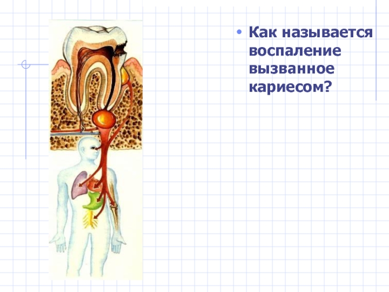 Как называется воспаление. Как называется воспаление вызванное кариесом. Презентация мышцы 8 класс УМК Пономарева. Как называется воспаление сальника. Как называется воспаление сумки.