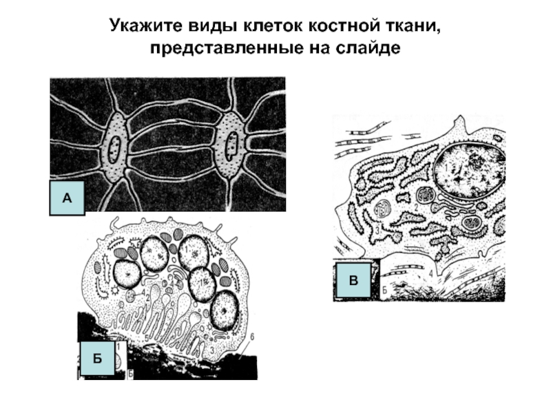 Клетки костной ткани рисунок