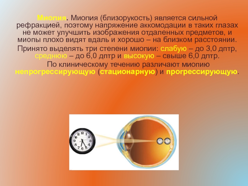 Характеристики изображения предметов на сетчатке глаза человека