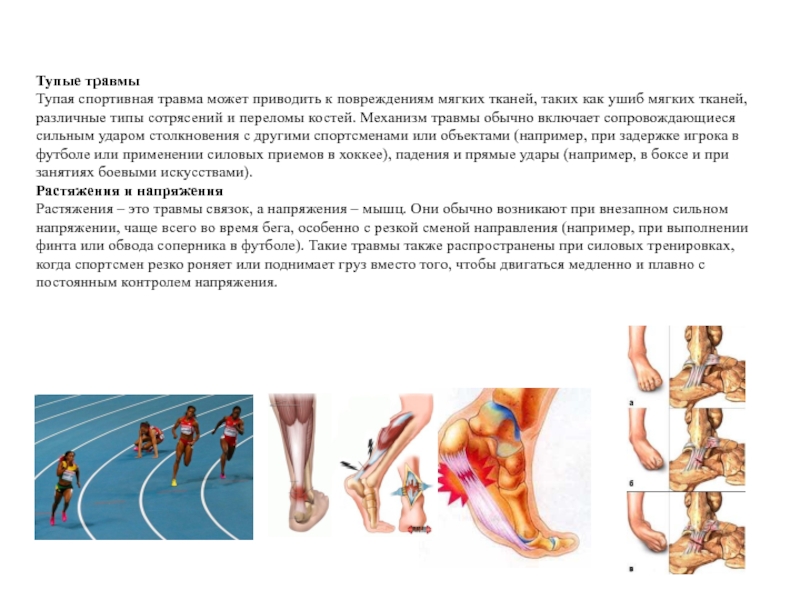 Что такое травма. Спортивные травмы. Механизм спортивного травматизма.