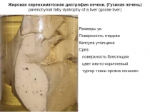 Жировая паренхиматозная дистрофия печени. (Гусиная печень) parenchymal fatty