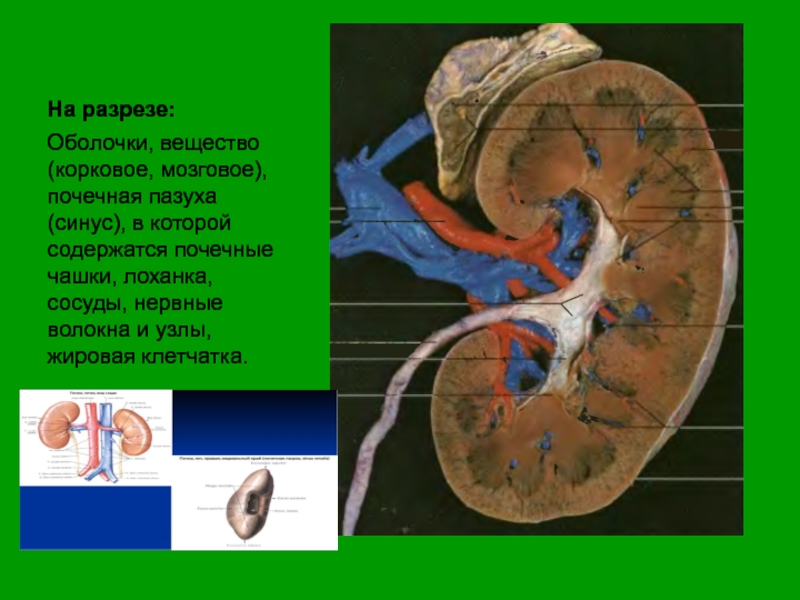 Синус почки фото