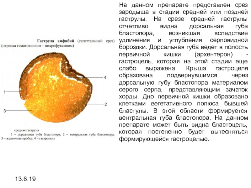 Представить препарат. Средняя гаструла лягушки препарат. Ранняя гаструла лягушки препарат. Поздняя гаструла лягушки препарат. Структуры ранней гаструлы лягушки.