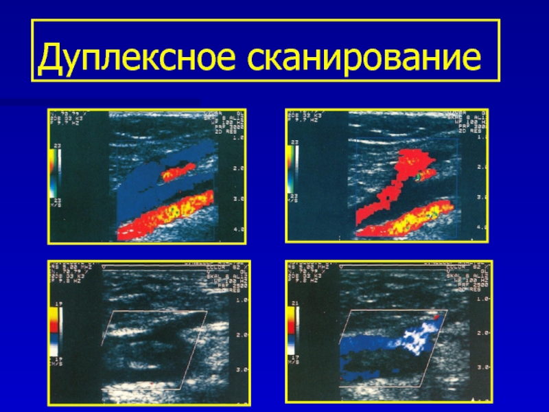 Что такое дуплексное сканирование