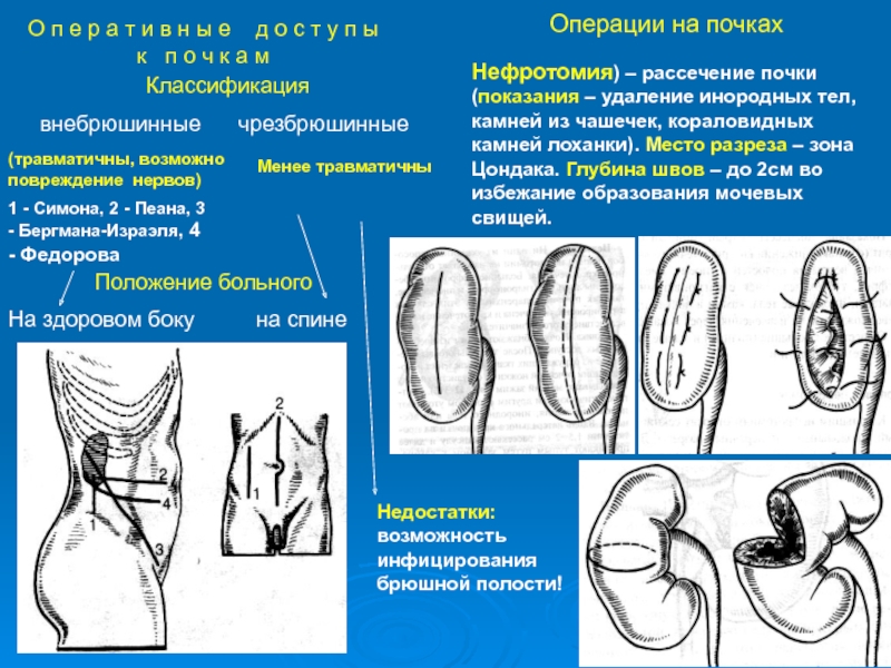 Презентация топография почек