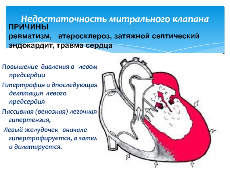 Хирургическое лечение пороков сердца презентация