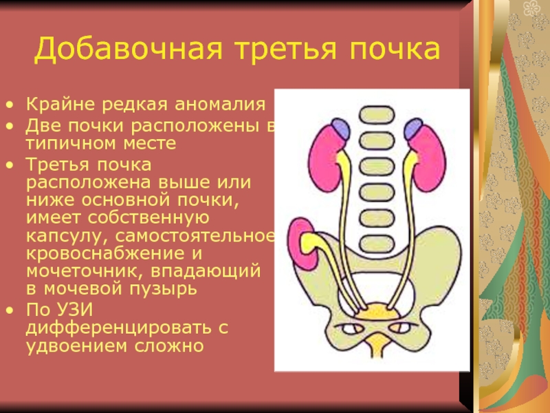 Аномалии мочеточников презентация