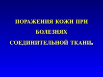 ПОРАЖЕНИЯ КОЖИ ПРИ БОЛЕЗНЯХ СОЕДИНИТЕЛЬНОЙ ТКАНИ