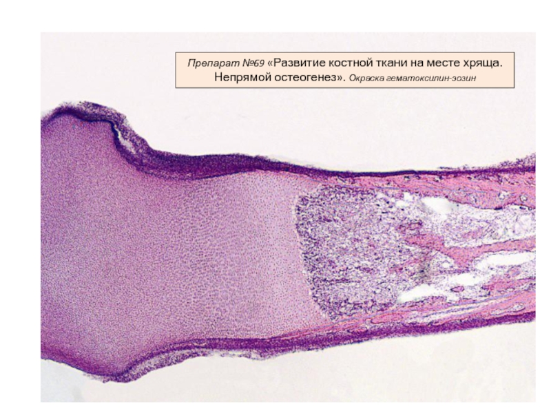 Развитие кости на месте хряща гистология рисунок