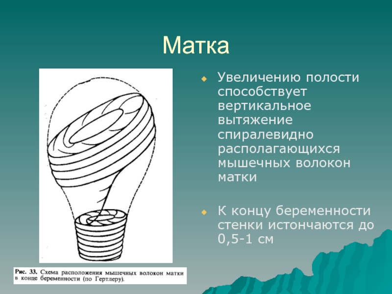 Полость увеличение. Мышечные волокна матки. Расположение мышечных волокон в матке. Мышцы матки. Расположение мышц матки.