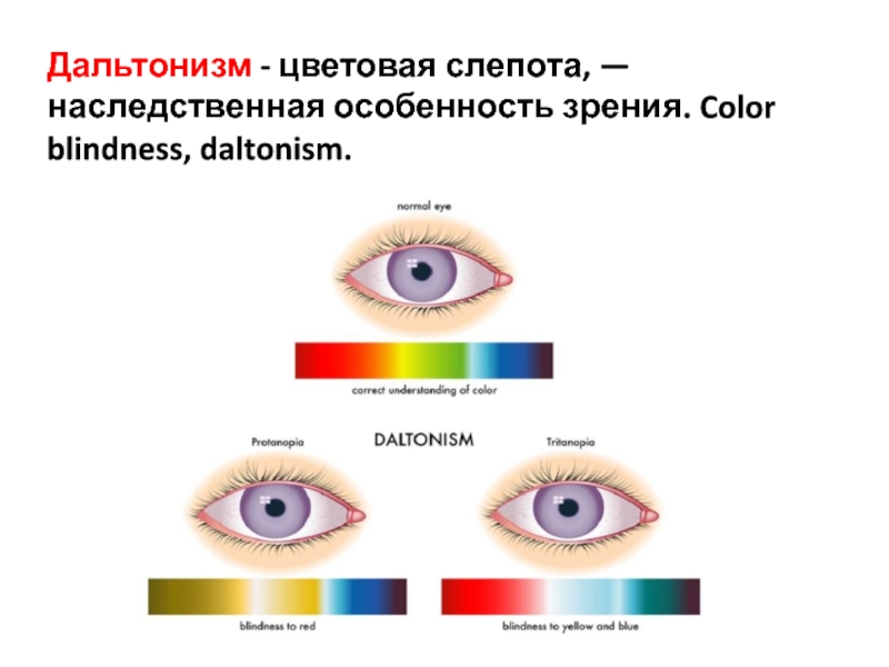 Дальтонизм фото для презентации